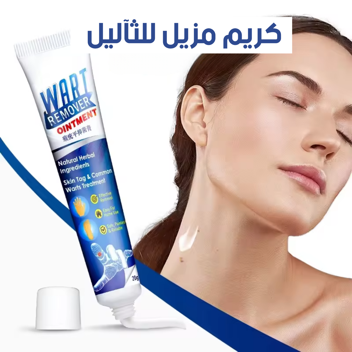 مرهم الثآليل wart remover