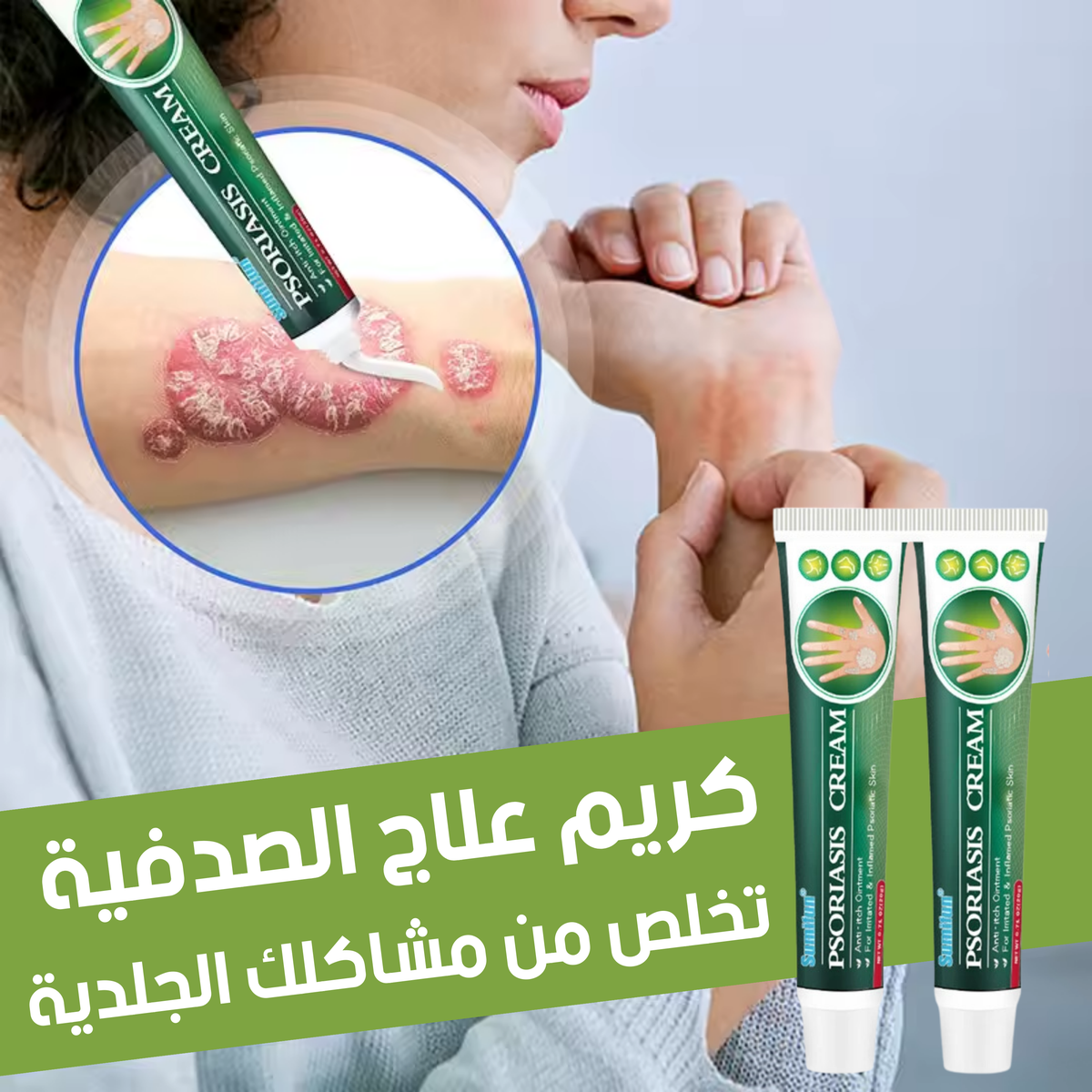 كريم علاج الصدفية و الاكزيما